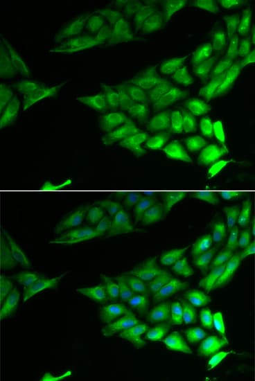 IHC-plus™ PSAT1 Antibody