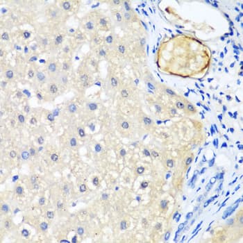 Polyclonal Rabbit anti-Human LRP5 Antibody (aa1000-1250, IHC, WB)