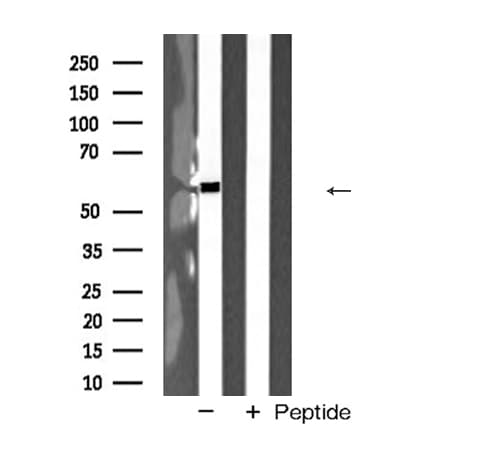 Polyclonal Rabbit anti-Human MAOA / Monoamine Oxidase Antibody (IHC, WB)