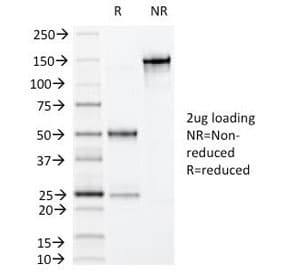 VIL1 / Villin Antibody (clone VIL1/1325)