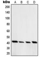 IHC-plus™ PRKAR1A Antibody (C-Terminus)