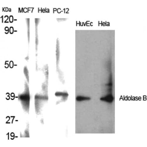 ALDOB Antibody (80-160 aa, Internal)