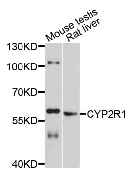 Cytochrome P450 2R1 / CYP2R1 Antibody