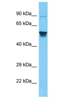 MRVI1 Antibody (aa51-100)