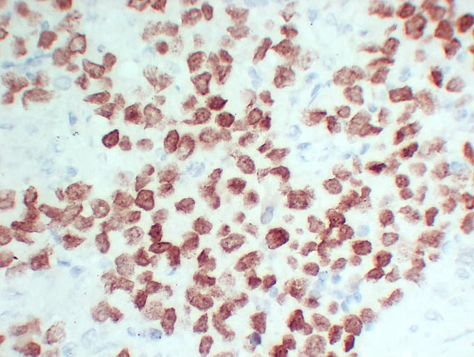 SALL4 Antibody (clone ABT-SALL4)