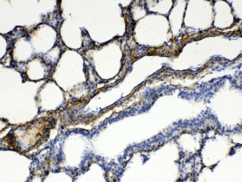 Polyclonal Rabbit anti-Human PPP1R14A / CPI-17 Antibody (IHC, WB)