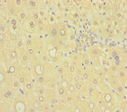 SAMD7 Antibody