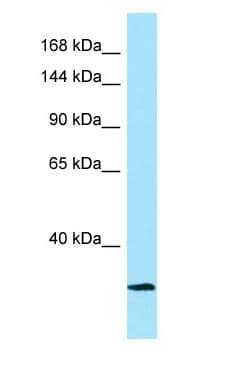 CAPN3 / Calpain 3 Antibody (aa124-173)