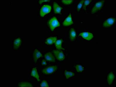 PTGR2 / PGR2 Antibody