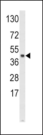 Polyclonal Rabbit anti-Human SKP2 Antibody (aa156-185, WB)