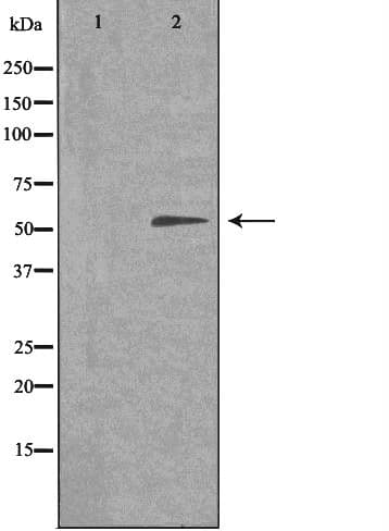 Polyclonal Rabbit anti-Human TIGD3 Antibody (IHC, IF, WB)