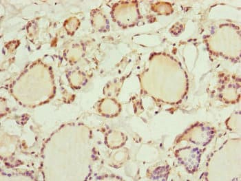 Polyclonal Rabbit anti-Human RNF11 Antibody (IHC)