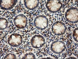CLPP Antibody (clone OTI1G9)