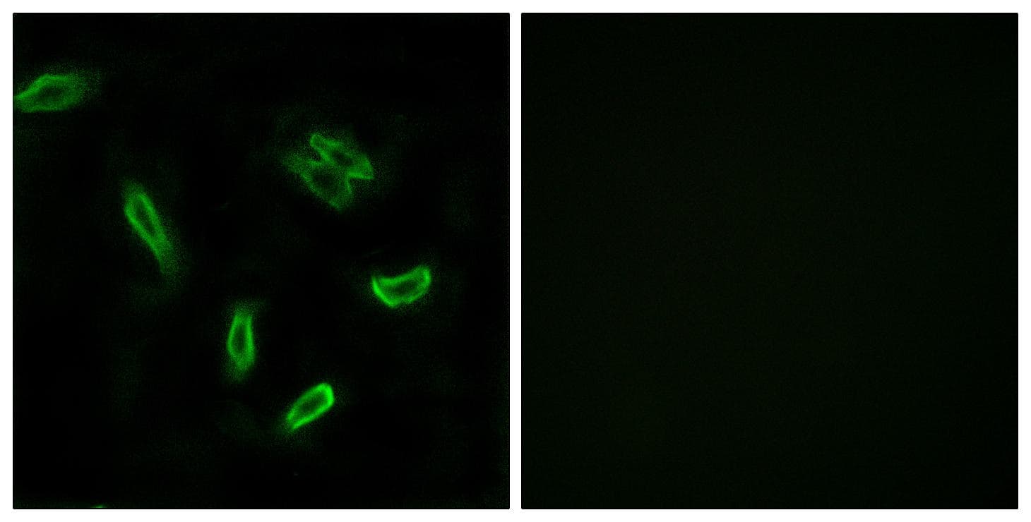 SLC27A5 / BACS Antibody
