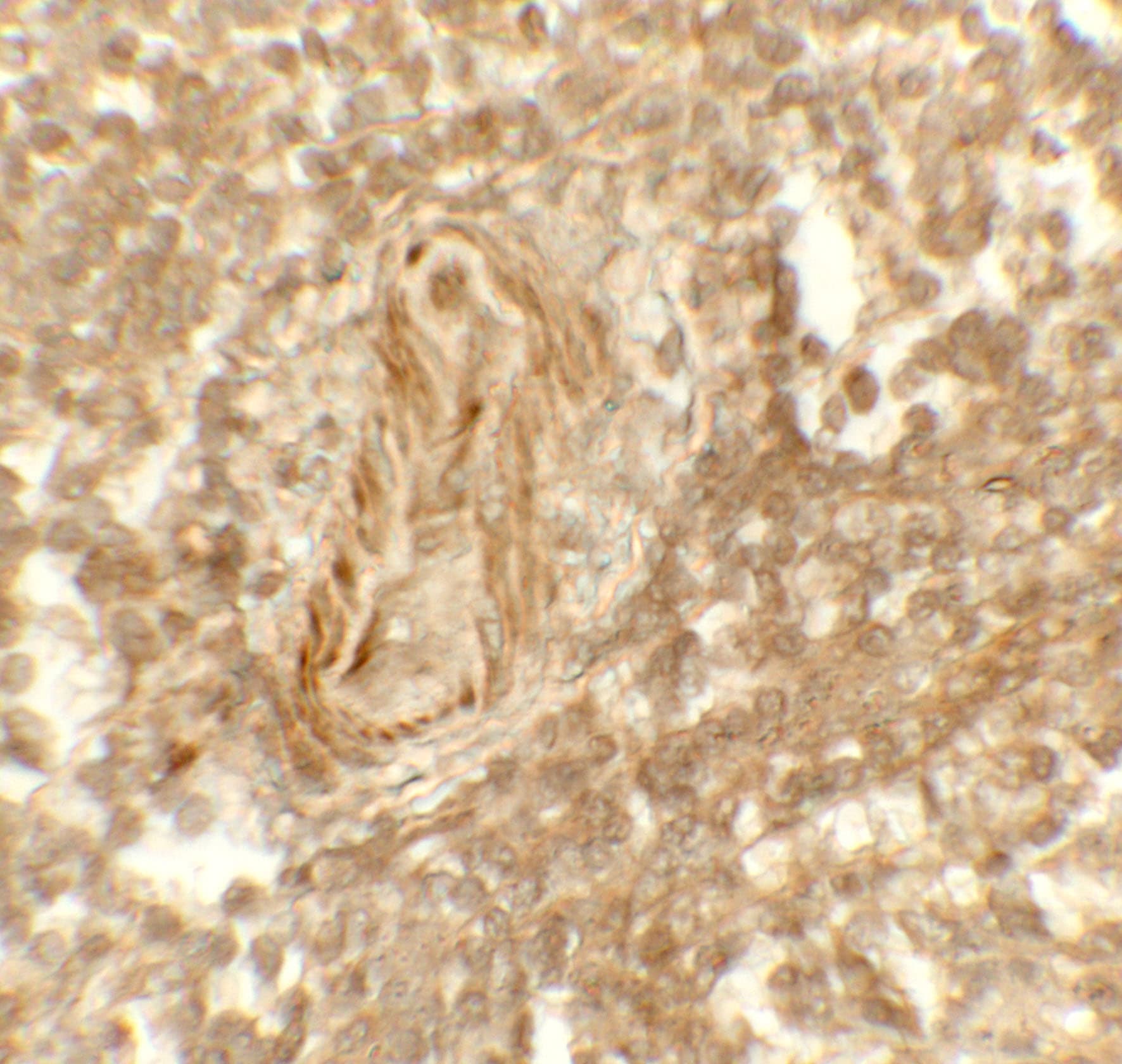 Polyclonal Rabbit anti-Human KDM1A / LSD1 Antibody (IHC, WB)