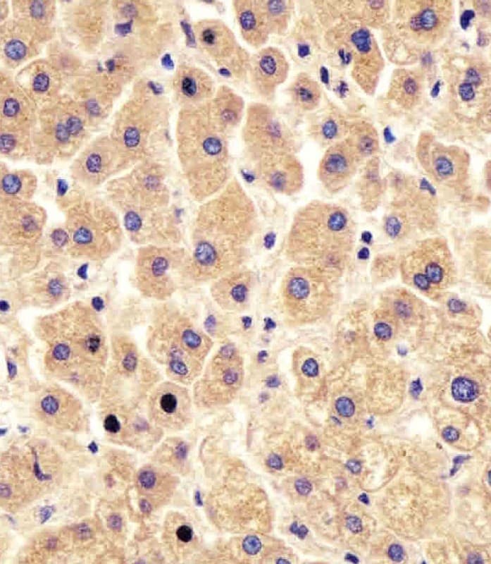 Polyclonal Rabbit anti-Human PYGL Antibody (aa809-843, IHC, WB)