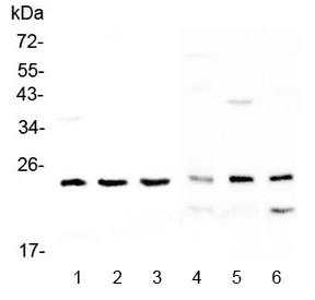 RAB6A / RAB6 Antibody