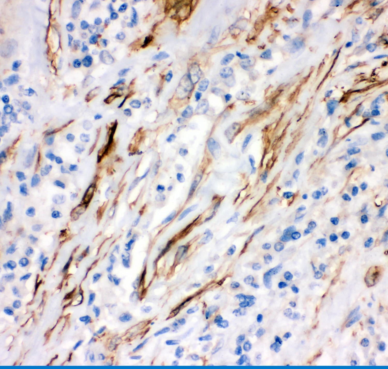 CD95 / FAS Antibody (aa26-173)