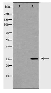 RAN Antibody