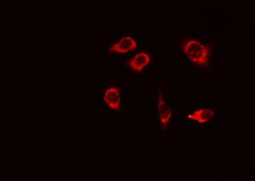 DSG1 / Desmoglein 1 Antibody