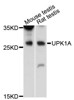 UPK1A / Uroplakin 1A Antibody