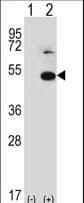Polyclonal Rabbit anti-Human TRIP13 Antibody (aa64-90, IHC, WB)