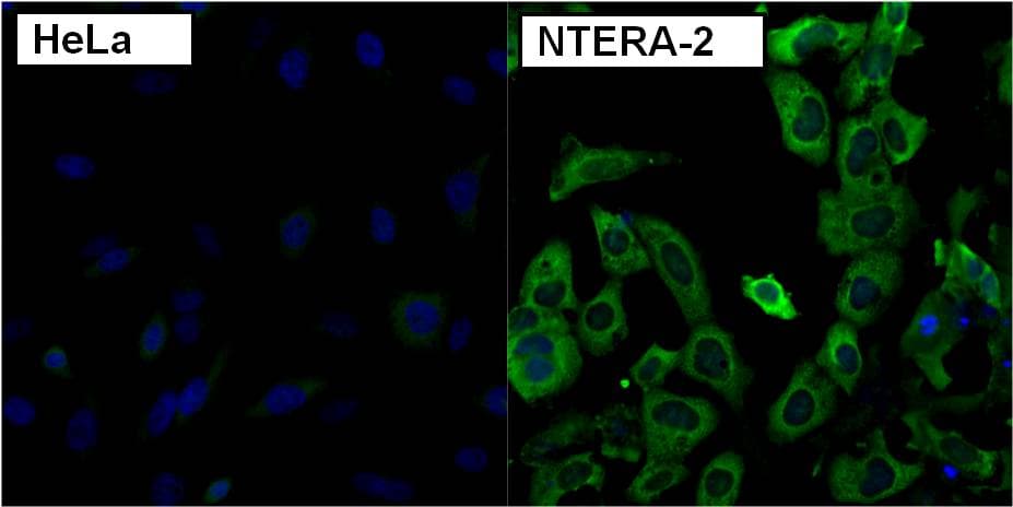 IHC-plus™ Polyclonal Rabbit anti-Human LIN28A / LIN28 Antibody (IHC, IF, WB)