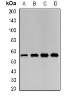 IHC-plus™ Polyclonal Rabbit anti-Human LAP3 Antibody (IHC, WB)