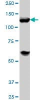 IHC-plus™ HDAC4 Antibody (clone 2B11)