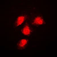ERK1 + ERK2 Antibody (Internal)