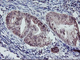 PPP1R15A / GADD34 Antibody (clone OTI3D12)