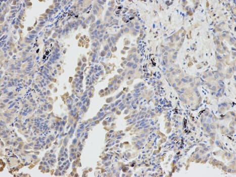 DPYD / DPD Antibody