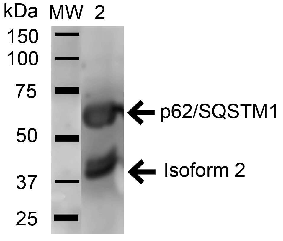 SQSTM1 Antibody