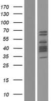 DACH2 Protein (Over-Expression Lysate Myc-DDK (Flag))
