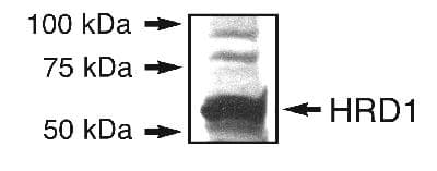 SYVN1 / HRD1 Antibody (aa300-400)