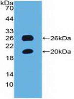 SPON1 / F-Spondin Antibody (aa608-802)