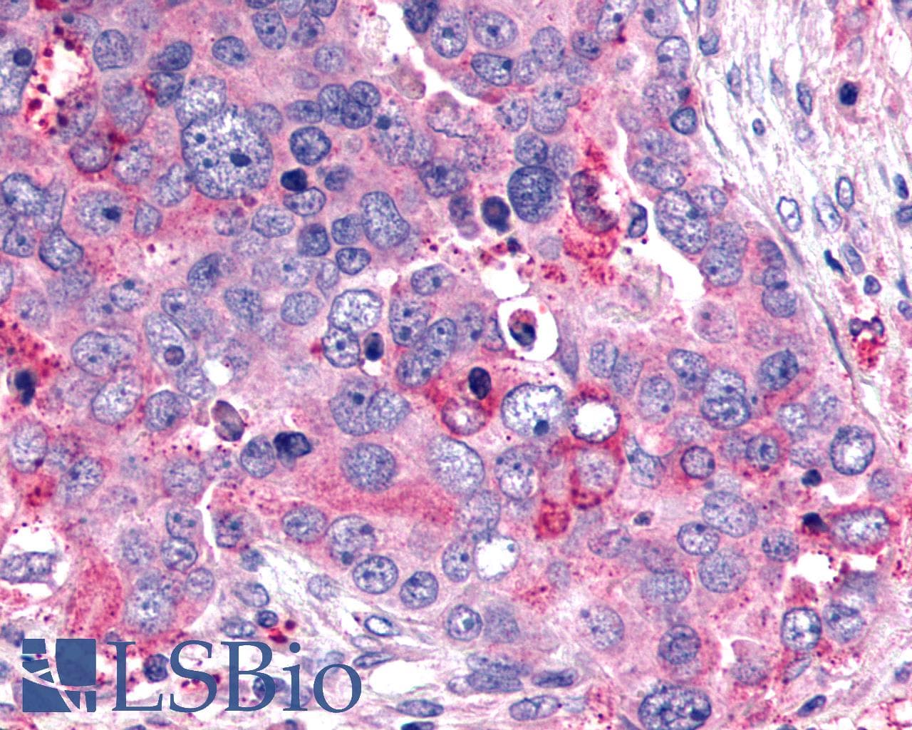 IHC-plus™ Polyclonal Rabbit anti-Human GHRHR Antibody (C-Terminus, IHC)
