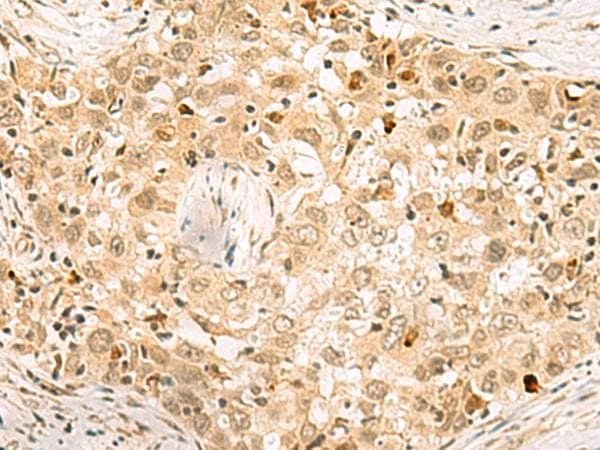 EXOSC4 / RRP41 Antibody