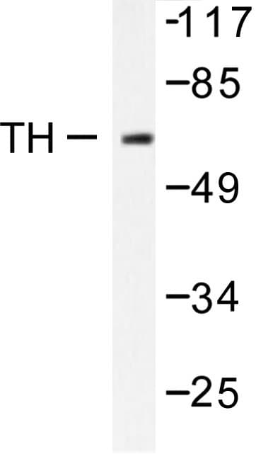 Polyclonal Rabbit anti-Human TH / Tyrosine Hydroxylase Antibody (Gln25, IHC, WB)