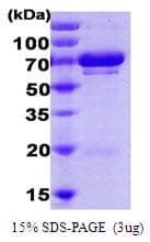 Human HSPA9 / Mortalin / GRP75 Protein (Recombinant His)