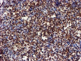 CYP17 / CYP17A1 Antibody (clone OTI3F11)