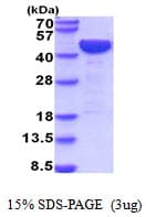 Mouse LRPAP1 Protein (Recombinant His)