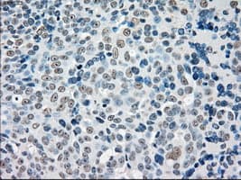 Monoclonal Mouse anti-Human STK3 Antibody (clone OTI2D4, IHC, WB)