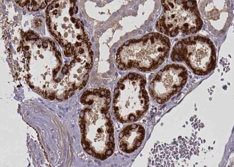 CPT1A Antibody