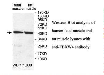 IHC-plus™ SHFM3 / FBXW4 Antibody (aa5-186)