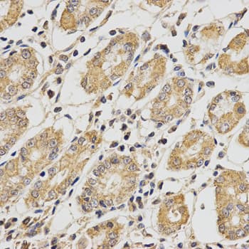 IHC-plus™ PCCB Antibody (aa289-539)