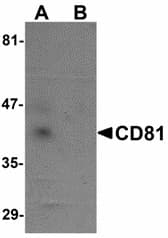 Polyclonal Rabbit anti-Human CD81 Antibody (IHC, IF, WB)