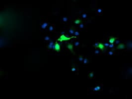 CATIP / C2orf62 Antibody (clone OTI2C6)