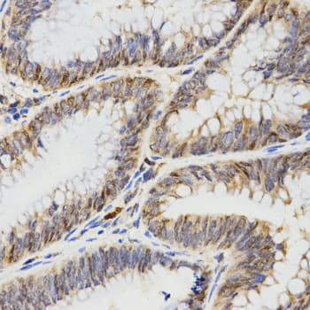 IHC-plus™ TPM2 Antibody