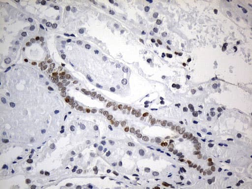 FOXP1 Antibody (clone UMAB242, Carrier-free)